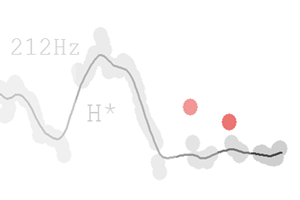 Advancing Prosodic Transcription